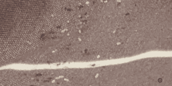 ביצי פשפש המיטה - 52 מעלות