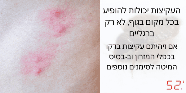 עקיצות פשפש המיטה בבטן - עקיצות בסריה - עקיצות פשפשים